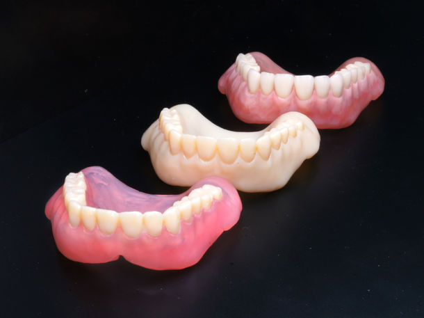 3Dプリンターで製造する義歯『ヨビーバ』   